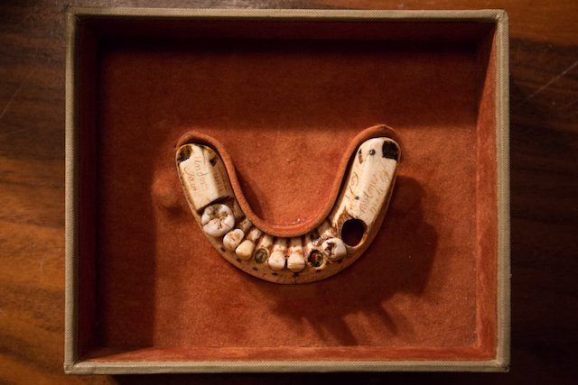 070617_teeth.jpg