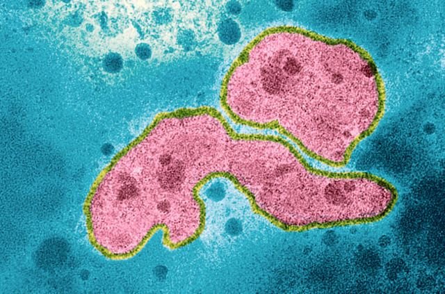 Bird flu, up close
