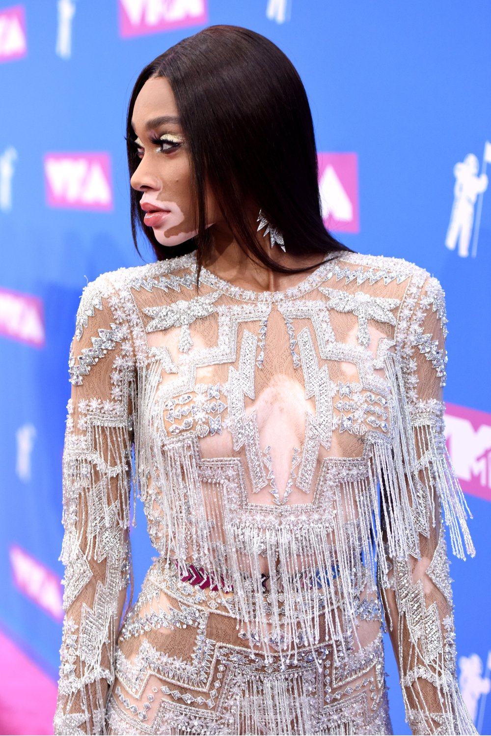 31370dacbshutterstock_9793063ac-jpg.jpeg Winnie Harlow<br/>