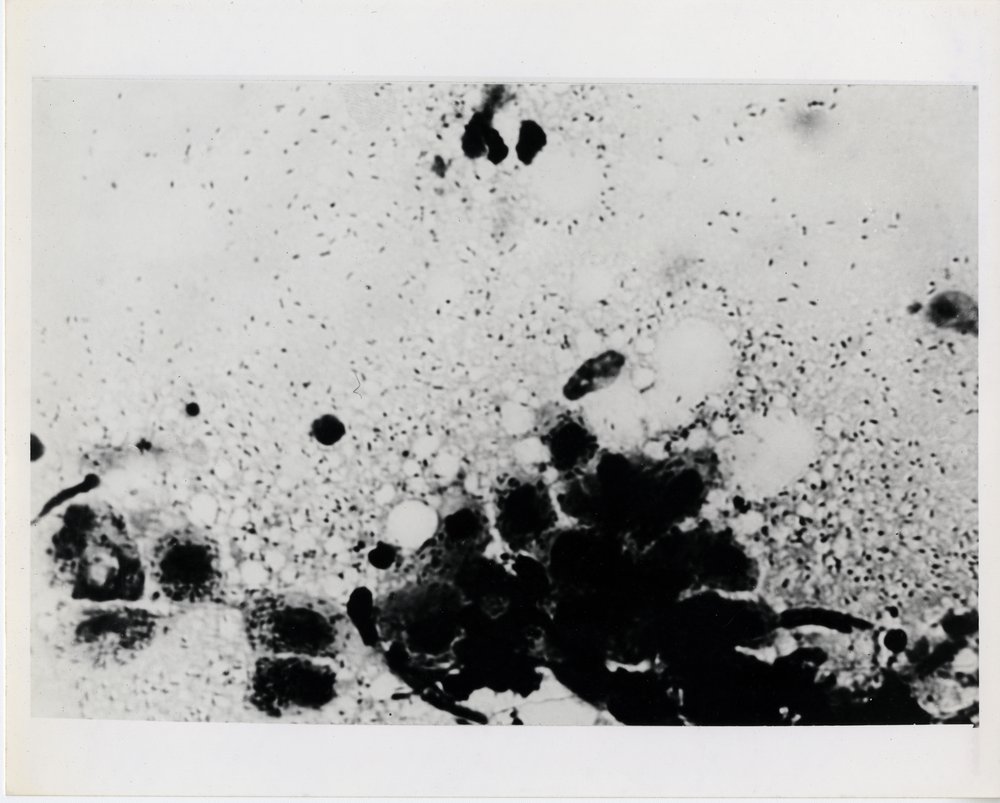 933355d80germcity_11-jpg.jpeg Microscopic image of the rickettsialpox organism, c. 1946-50. (Courtesy of NIH Stetten Museum of Medical Research, National Institutes of Health, 1553-Ph B)
