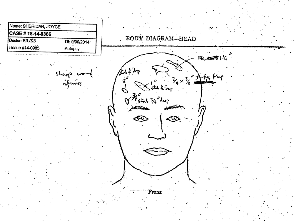 Image from Joyce Sheridan's autopsy performed by the Assistant State Medical Examiner, New Jersey, shows stab wounds