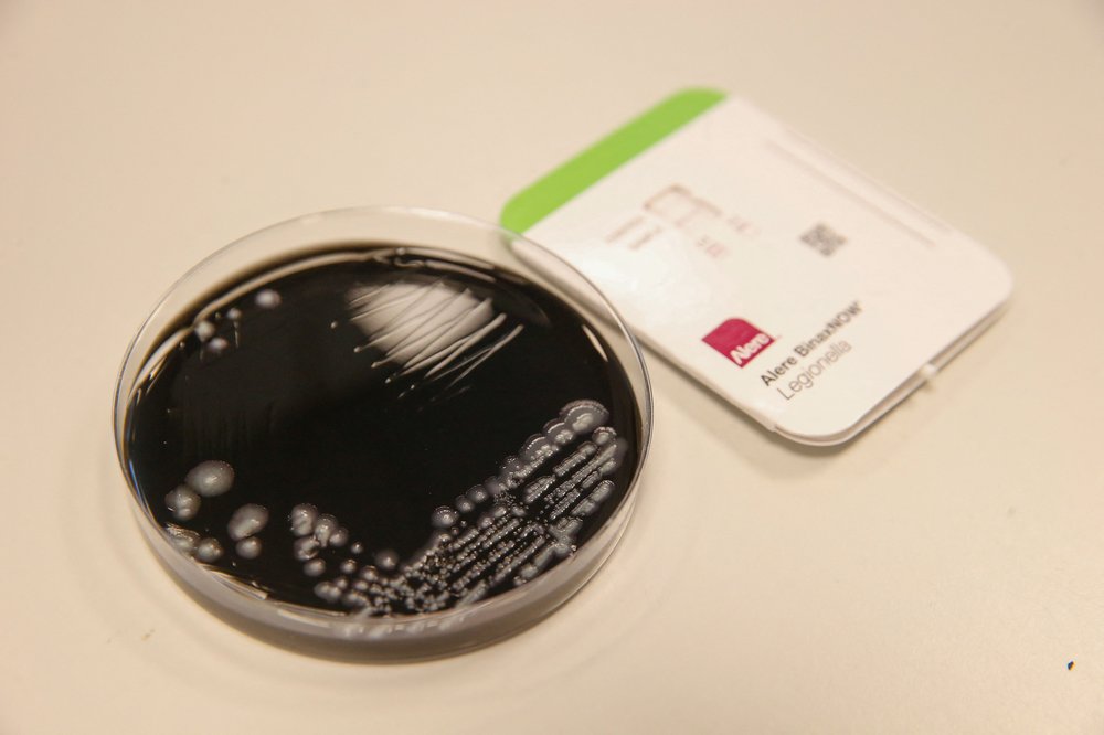 A test for Legionella pneumophila bacteria.
