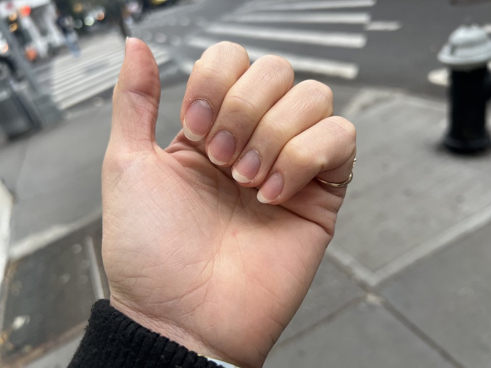 A close up of the author's nails before the manicure.