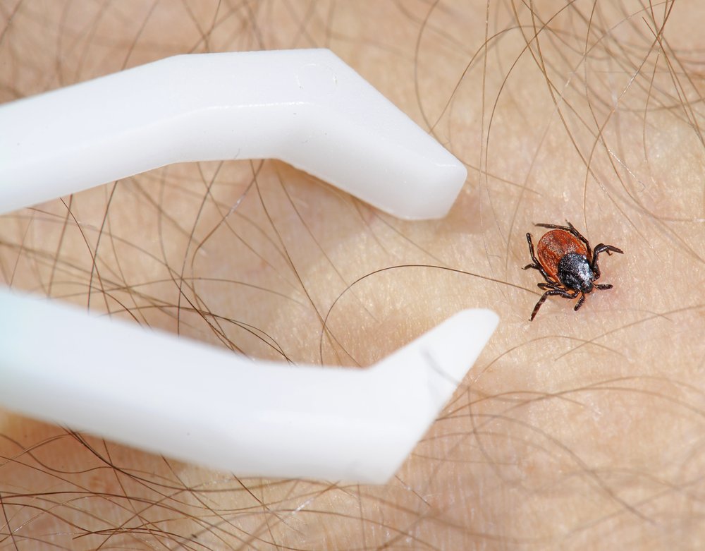 Black-legged tick on human skin